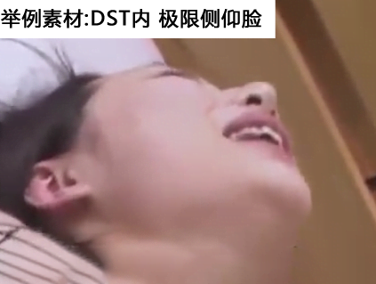 大角度/死亡角度解决方案